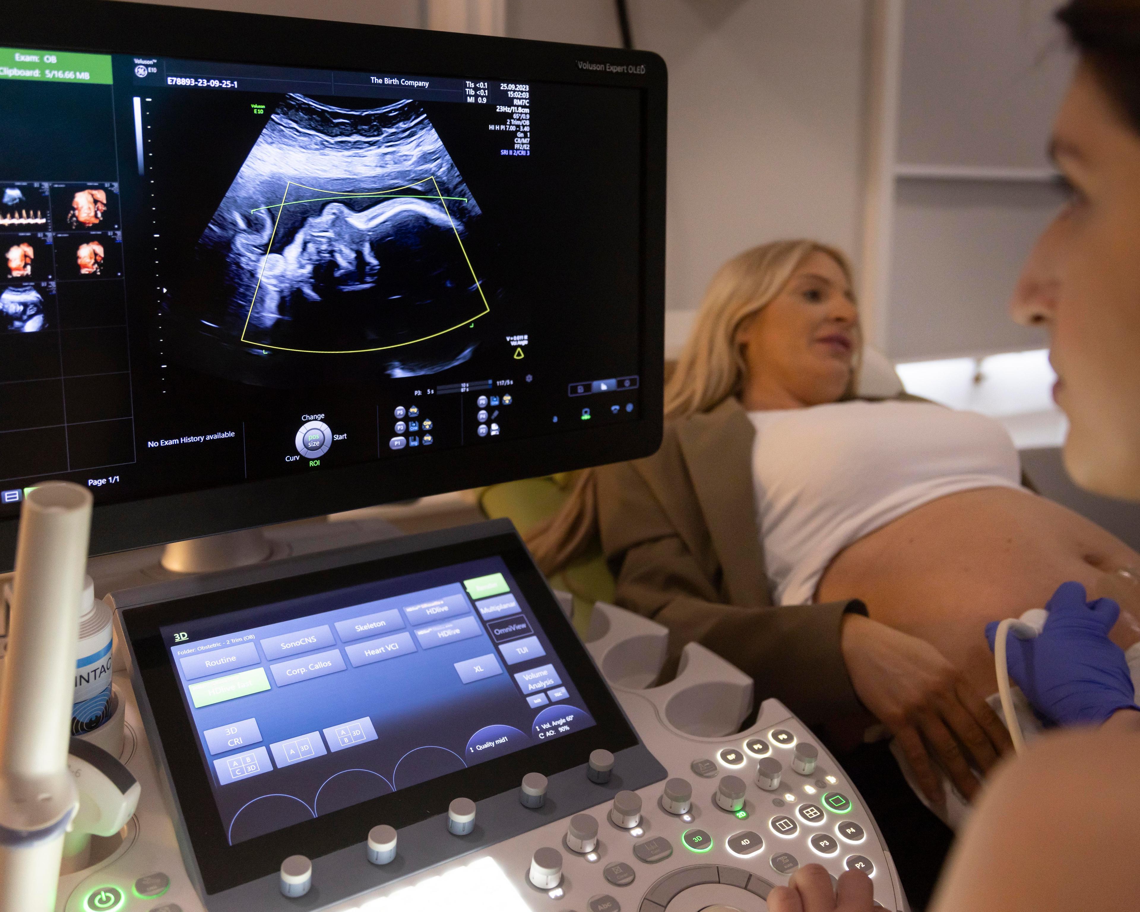 Ultrasound on pregnant lady